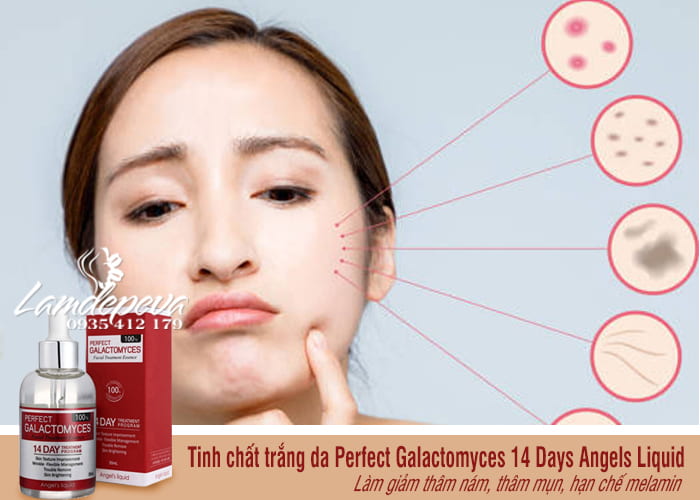 Tinh chất Angel’s Liquid Perfect Galactomyces 14 Days 55ml 2