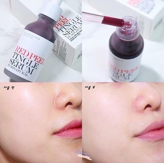 Red Peel Tingle Serum Hàn Quốc - Peel da không bong tróc 35ml 1