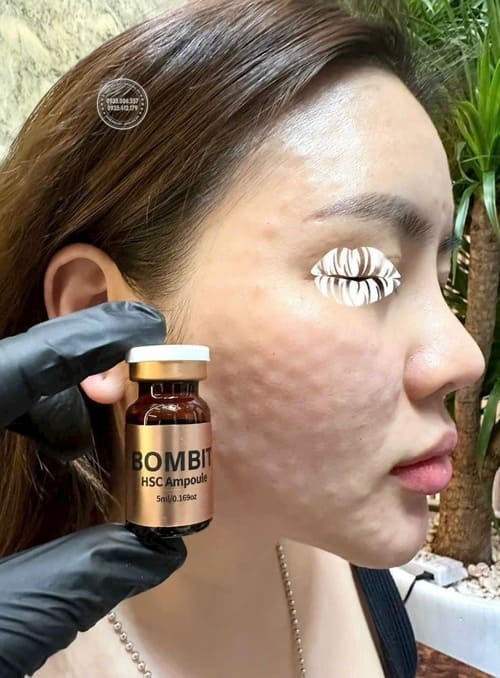 serum-tre-hoa-da-bombit-hsc-ampoule-co-tot-khong-review-chi-tiet1